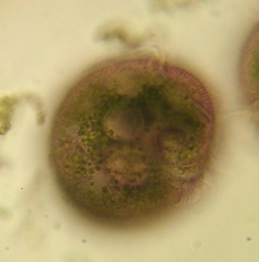Stentor amethystinus