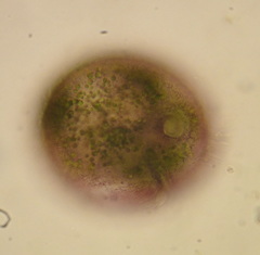 Stentor amethystinus