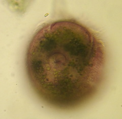 Stentor amethystinus