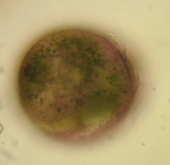 Stentor amethystinus