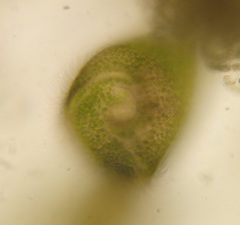 Stentor amethystinus