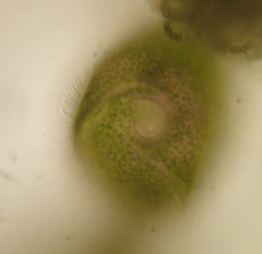 Stentor amethystinus