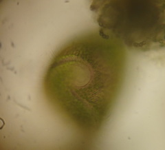 Stentor amethystinus