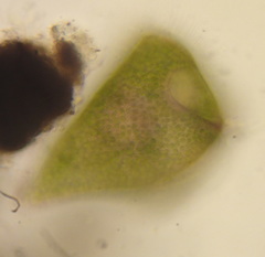 Stentor amethystinus