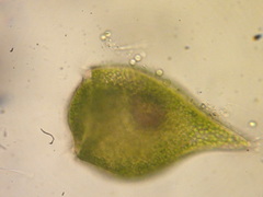 Stentor amethystinus