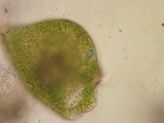 Stentor amethystinus