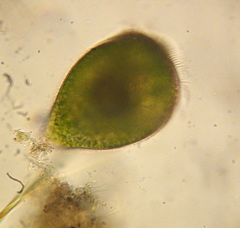 Stentor amethystinus