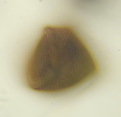 Stentor amethystinus