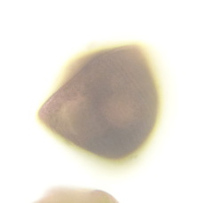 Stentor amethystinus