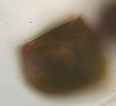 Stentor amethystinus