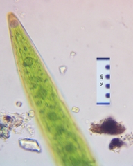 Closterium acerosum