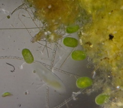 Frontonia