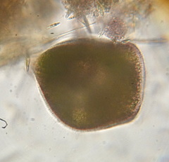 Stentor amethystinus