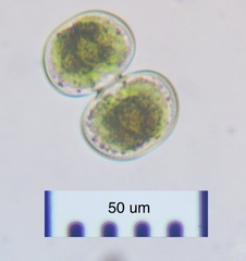 Cosmarium contractum