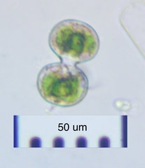 Cosmarium contractum