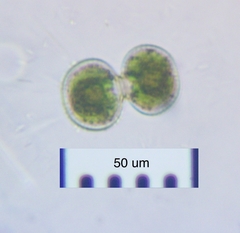 Cosmarium contractum