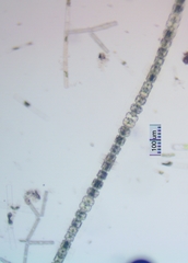 Desmidium