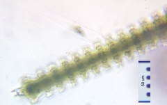 Triploceras verticillatum
