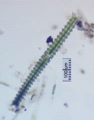 Triploceras verticillatum