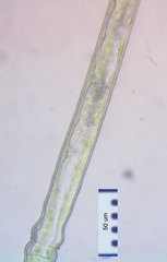 Pleurotaenium