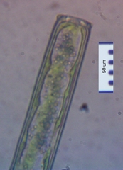 Pleurotaenium