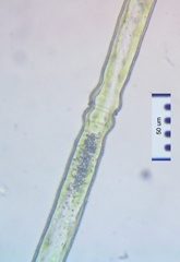Pleurotaenium