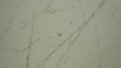 Tyrophagus putrescentiae