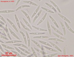 Hymenoscyphus menthae