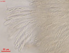 Hymenoscyphus menthae