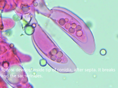 Entomophthoraceae