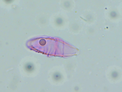 Entomophthoraceae