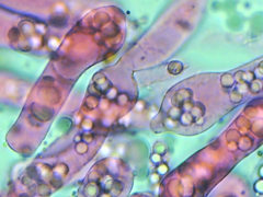 Entomophthoraceae