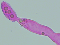 Entomophthoraceae