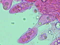 Entomophthoraceae