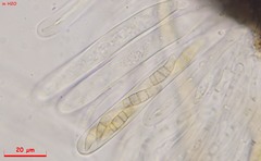 Leptosphaeria