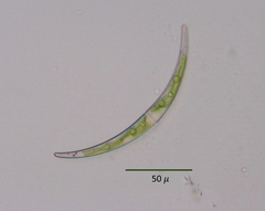 Closterium parvulum