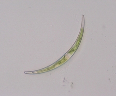 Closterium parvulum