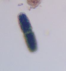 Tetmemorus brebissonii