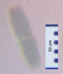 Tetmemorus brebissonii