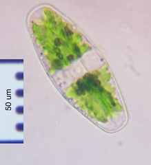 Netrium digitus