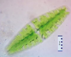 Netrium digitus