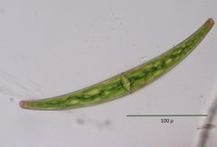 Closterium archerianum