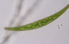 Closterium archerianum