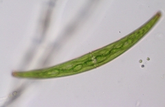 Closterium archerianum