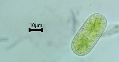 Cylindrocystis