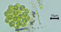 Coelastrum