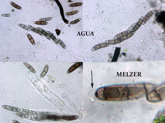 Chaetosphaerella fusca