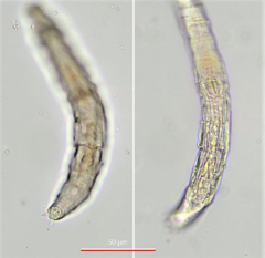 Habrotrocha collaris