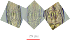 Habrotrocha collaris