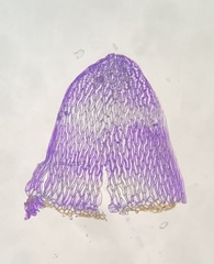 Sphagnum subsecundum